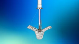 Abbott Launches Comprehensive Real-World Study for TriClip as Competition Intensifies in the Tricuspid Valve Repair Market