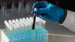 Tempus AI Announces Strategic Acquisition of Personalis to Bolster Precision Oncology and Liquid Biopsy Capabilities