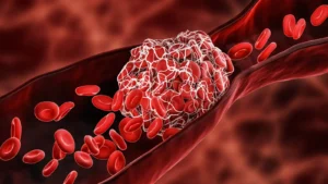 ARPA-H Allocates 175 Million Dollars to Advance Autonomous Robotic Systems for Rapid Stroke Intervention