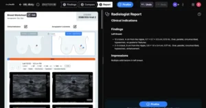 DeepHealth Secures FDA Clearance for AI-Powered Breast Ultrasound Tool Enhancing Detection Sensitivity and Workflow Efficiency