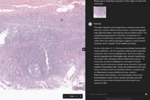 FDA Navigates Regulatory Frontier for Generative Artificial Intelligence in Medical Devices as Medtech Industry Awaits Clearer Guidance