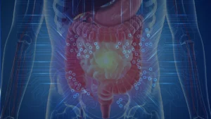 Revolutionizing Nutraceutical Development: AI and Microbiome Modeling Usher in an Era of Precision Health