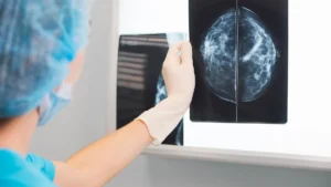 Vara Secures EU Regulatory Approval for Autonomous AI-Driven Breast Cancer Screening to Address Global Radiologist Shortage