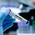 Closing the Diagnostic Gap in Hypophosphatasia and Advancing Clinical Awareness for World HPP Day