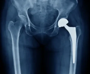 Stryker Adjusts Financial Outlook as Economic Pressures Dampen Joint Replacement Demand and Leadership Prepares for Strategic Transition
